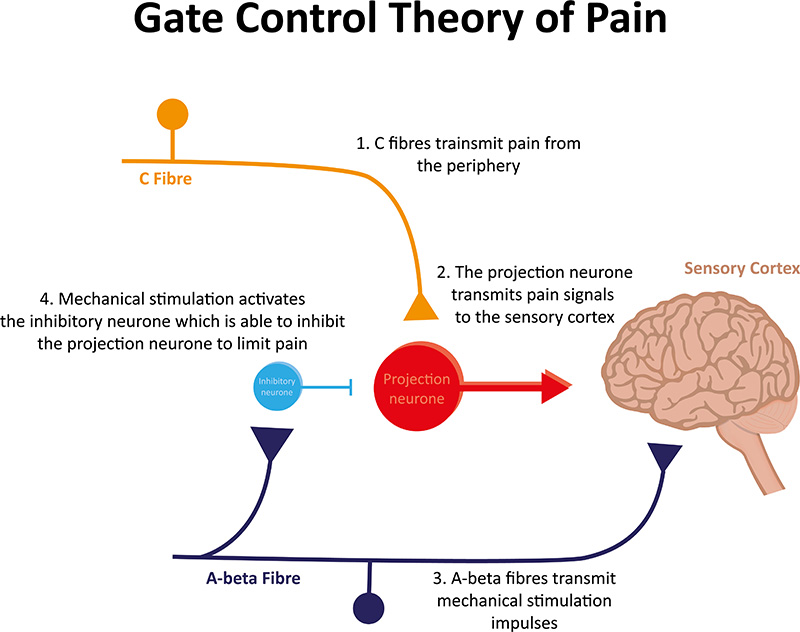 Mind map displaying gate control theory of pain.