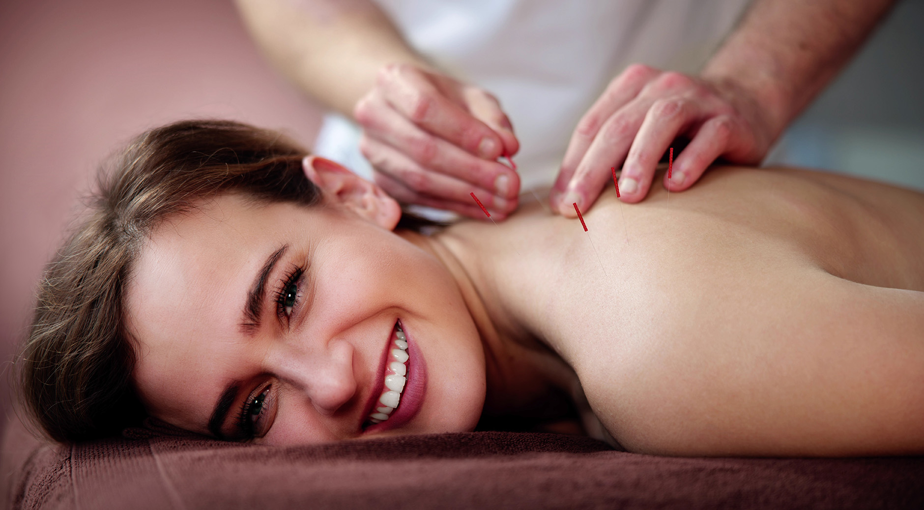 Young woman getting dry needling on upper back to treat musculoskeletal pain at Lee Schwalb Acupuncture in NYC.