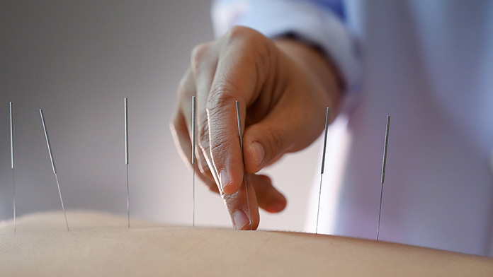 Why Medical Doctors Refer Patients to Acupuncturists: Bridging Modern Medicine and Traditional Healing