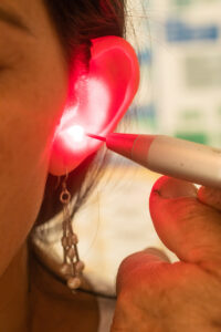 Acupunture in ear with laser. Chinese Medicine